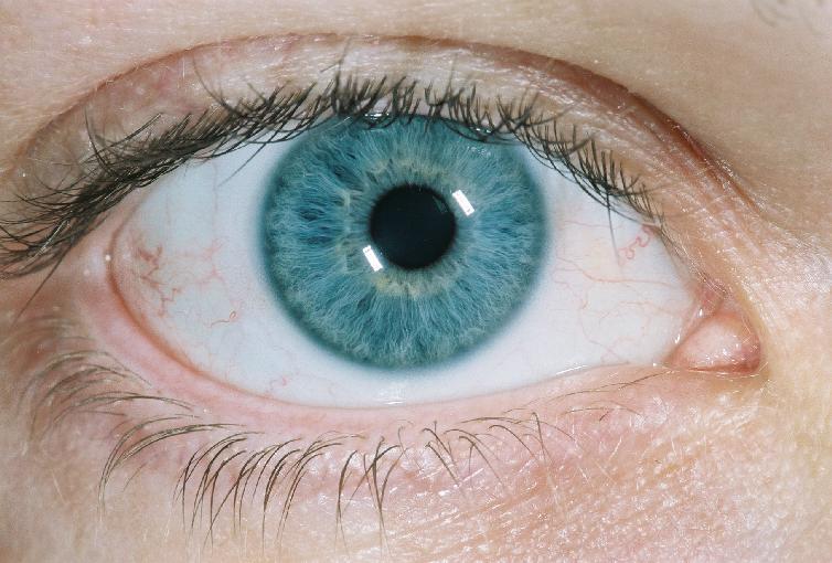 right eye, take 1