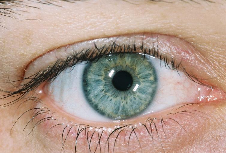 right eye - flower - 2